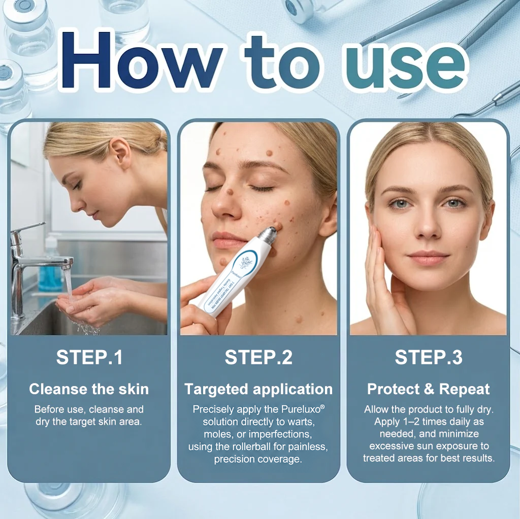 Pureluxo® Skin Tag Remover Roller💥💥