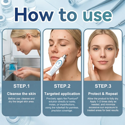 Pureluxo® Skin Tag Remover Roller💥💥