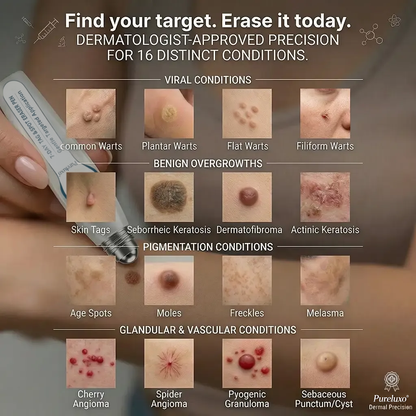 Pureluxo® Skin Tag Remover Roller💥💥