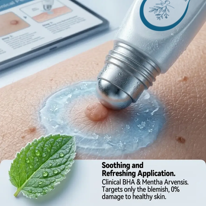 Pureluxo® Skin Tag Remover Roller💥💥